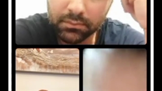 لایو پزشکی در مورد واکسن کرونا-گفتگوی پیمان روشن ضمیر با دکتر رزازیان- قسمت ۱۷ زاویه سازی صورت