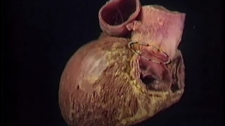 بطن ها آکلند دوبله فارسی