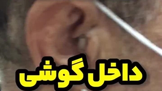 سمعک داخل گوش