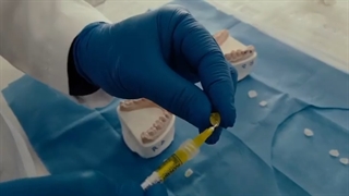 مراحل انجام لمینت (نکات فوق تخصصی) | کلینیک سیمادنت