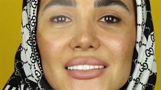 مراجعه کننده عزیزمون بعد از 3 سال برای انجام پالیش