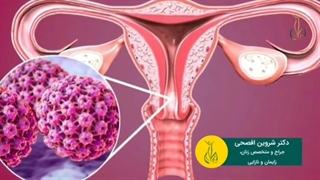برای درمان ضایعات پوستی افراد مبتلا به hpv از چه روشی استفاده میشود ؟ 