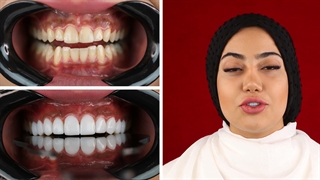 قوت قلب دکتر به من و تصمیم برای داشتن لبخند زیبا در کیلینیک عرشیان