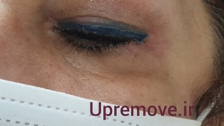 بعد ریمو خط چشم پررنگ تر میشود