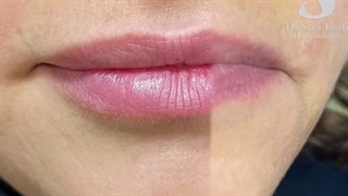 مگه میشه لب جوان بشه؟