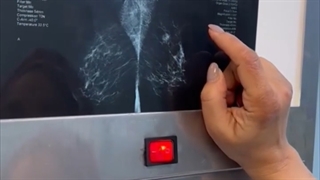 فیلم واقعی درمان جراحی سینه