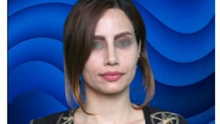 نمونه کار قبل و بعد جراحی بینی