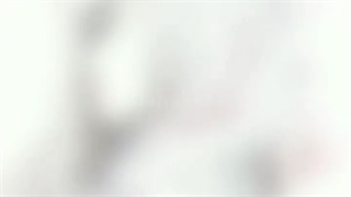 نمونه کار جراحی زیبایی بینی