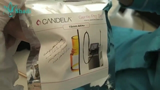 با موهای زائد برای همیشه خداحافظی کن