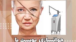 جوانسازی صورت با لیزر