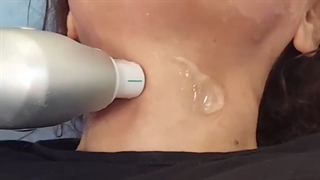 هایفوتراپی صورت