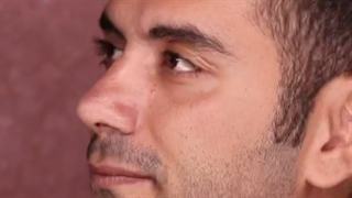 رضایت مندی مراجعه کننده عزیز از جراحی رینوپلاستی