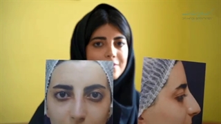 رضایت از عمل بینی یعنی این !! 