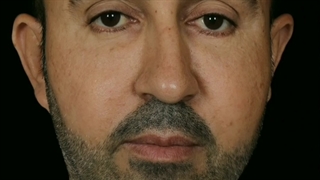 زیبایی درمانی در بین مردان.