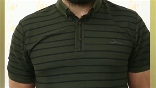 رضایت عمل لیفت دایرکت- کلینیک vip تهران