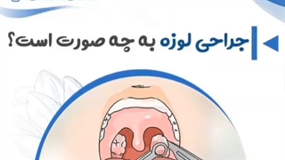 جراحی لوزه
