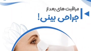 بعد عمل بینی چیکار کنیم؟