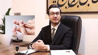 بیماری پسوریازیس علائم ناخنی هم دارد؟