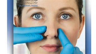 چرا انحراف بینی