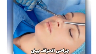 جراحی پلاستیک بینی