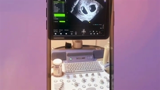 ⭕ پروژسترون را خودسرانه قطع نکنید! ⭕