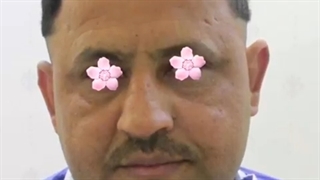 جراح اتوپلاستی گوش