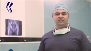 چه بیمارانی نیاز به جراحی  تعویض مفصل لگن دارند؟