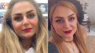 حس خوب رضایت مراجعه کننده از جراحی رینوپلاستی