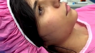 فیلم جراحی بینی بدون سانسور