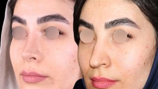 چقدر خوش فرم شده!