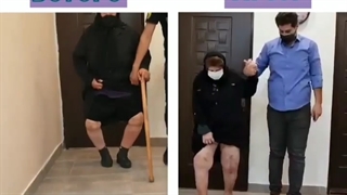 تعویض مفصل زانو