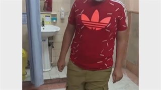 نتیجه درمان جراحی پرتس بعد از ۷ سال