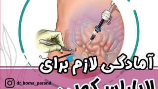 قبل لاپاراسکوپی چکار باید کرد
