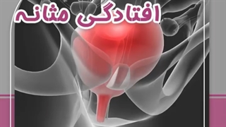 علائم افتادگی مثانه