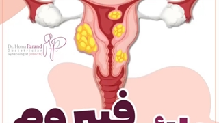 علائم فیبروم