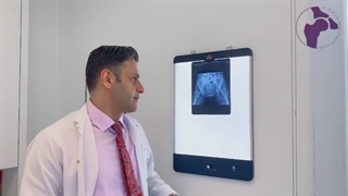 خانم ۳۵ ساله جوانی که با شکایت از......