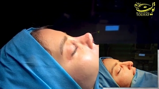 جراحی بینی به روش طبیعی