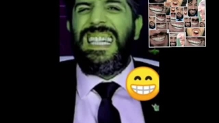 راز زیبایی دندان های امید دانا لو رفت