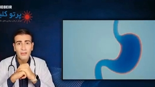 درمان نفخ شکم و گاز مقعد - partoclinic.com