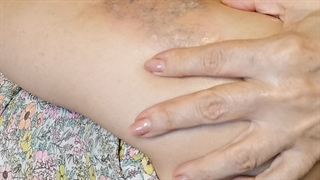 پاک کردن تتو با بهترین دستگاه لیزر