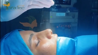 نمونه ای از جراحی بینی همراه با غوز