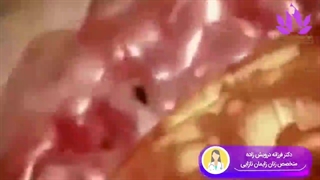 از اسپرم تا نوزاد