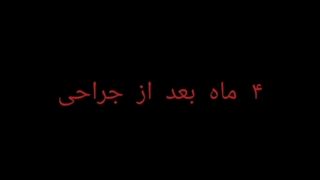 جراحی بینی