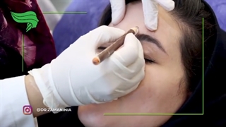 دیگه با چین و چروک پیشانیت خداحافظی کن به راحتی