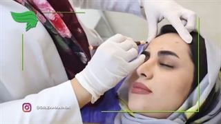 خداحافظی کنید دیگه با سیاهی زیر چشم هاتون