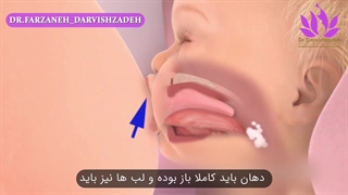 شیردهی غیر موثر