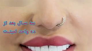 رضایت و لبخند زیبای مراجعه کننده محترممون