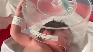 تولد نوزاد با دستگاه اکسیژن ساز