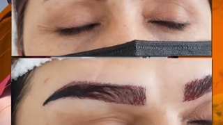 با یه جراحی ساده ابروهای طبیعی داشته باش