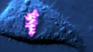 تولد یک سرطان پستان